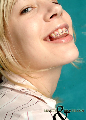 Beautyandbraces Beautyandbraces Model Comprehensive Mouth Premium Download