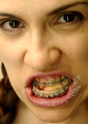 Beautyandbraces Model jpg 3