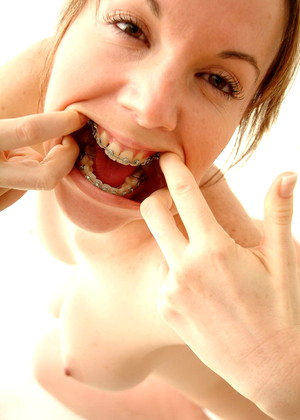 Beauty And Braces Beautyandbraces Model Sensual Fetish Life jpg 2